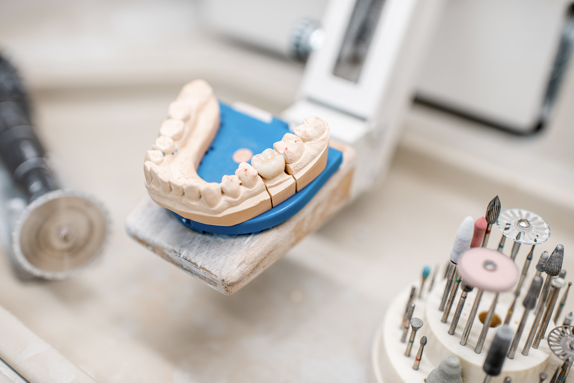 @elements.envato.com/de/user/RossHelen Zahnimplantate, Zahnersatz, Vollkeramik